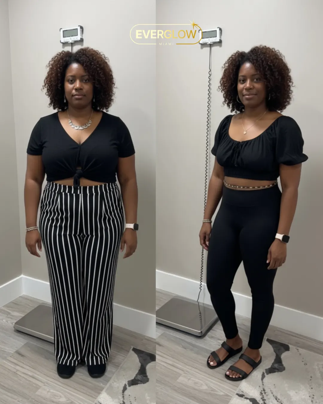 An Everglow Miami patient before and after