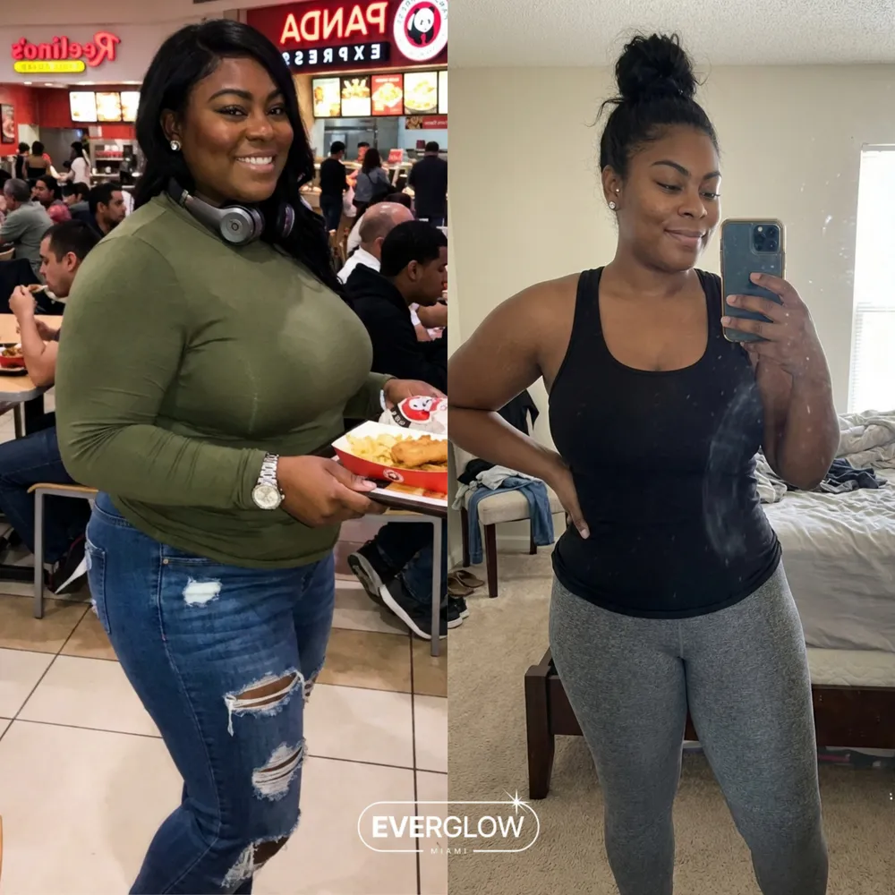 An Everglow Miami patient before and after