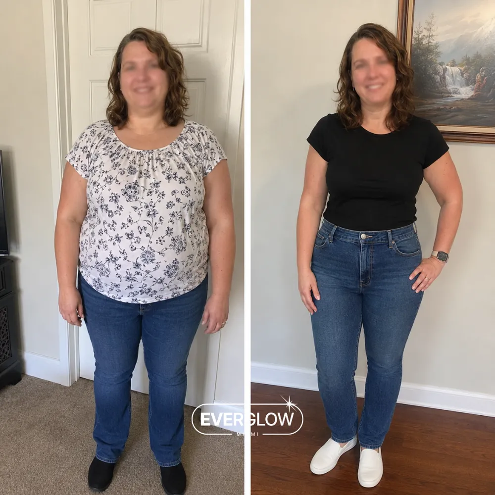 An Everglow Miami patient before and after