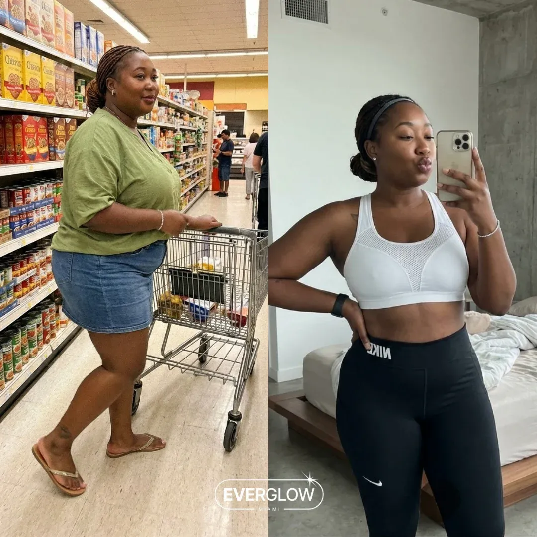 An Everglow Miami patient before and after