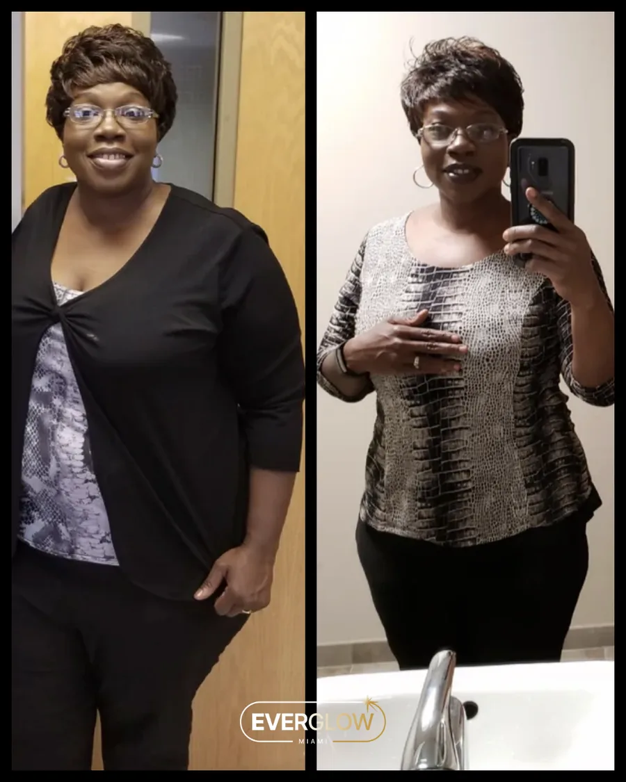 Everglow Miami patient before and after weight loss transformation