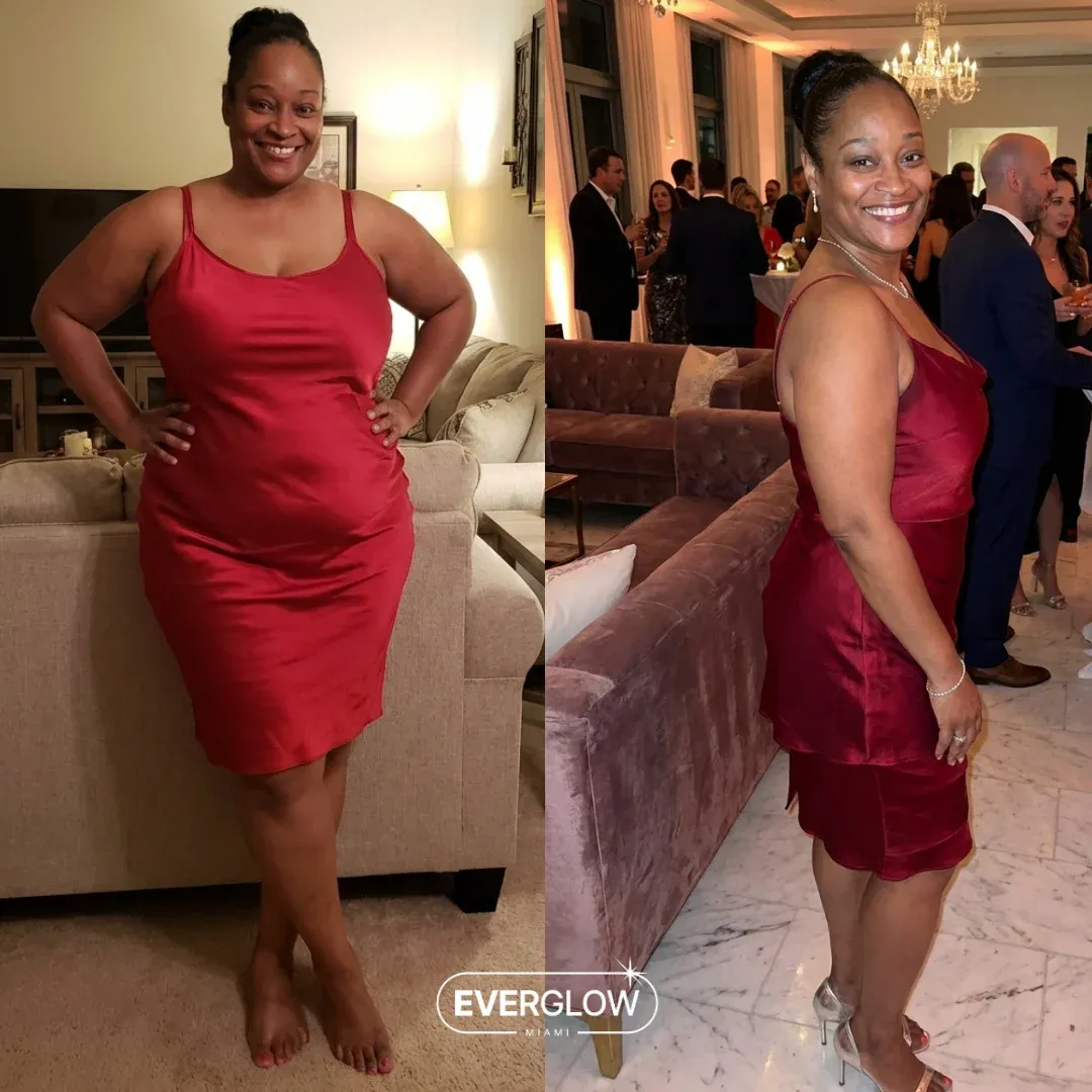 An Everglow Miami patient before and after