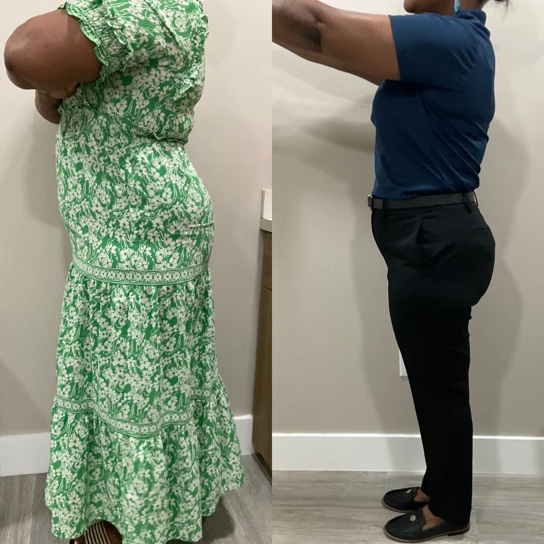An Everglow Miami patient before and after