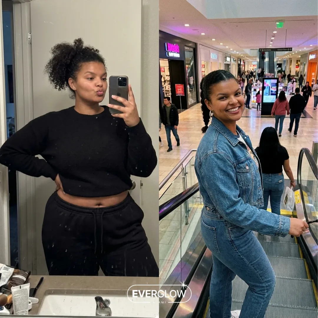 An Everglow Miami patient before and after
