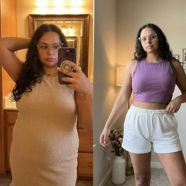 Everglow Miami patient before and after