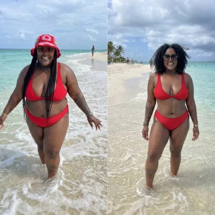 Everglow Miami patient before and after