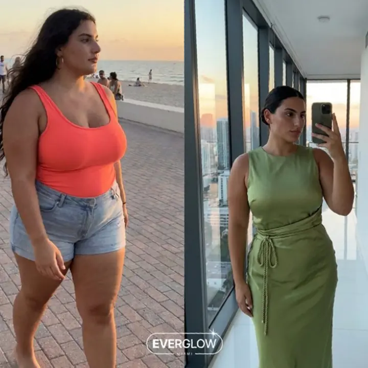Everglow Miami patient before and after