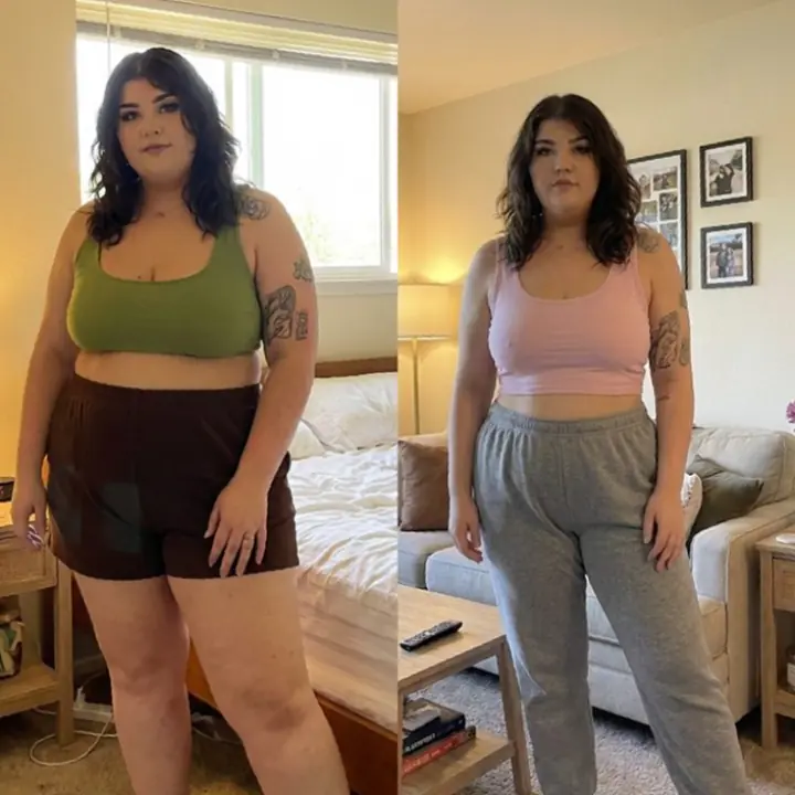 Everglow Miami patient before and after