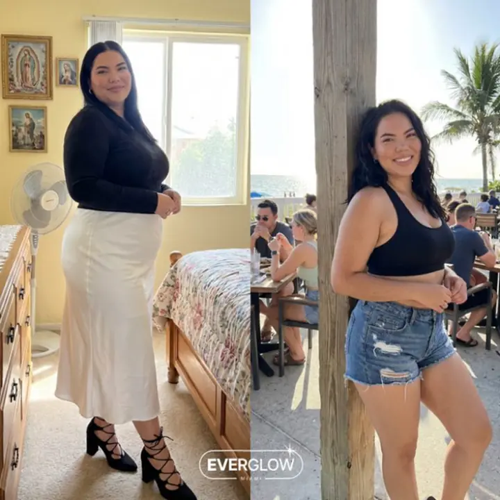 Everglow Miami patient before and after