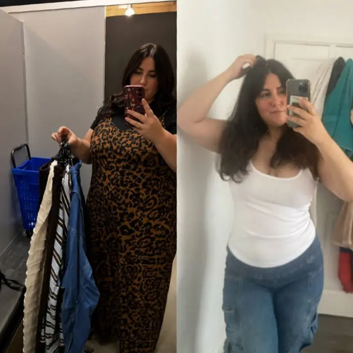 Everglow Miami patient before and after