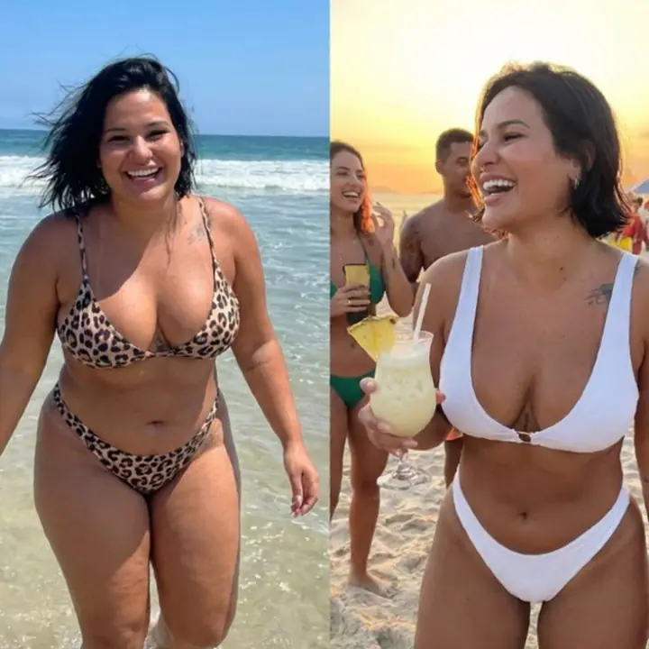 Everglow Miami patient before and after