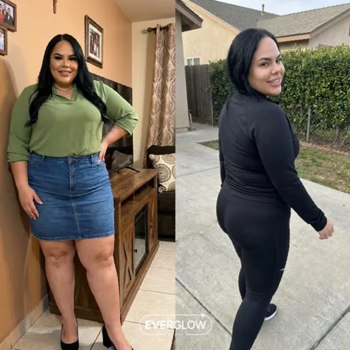 Everglow Miami patient before and after