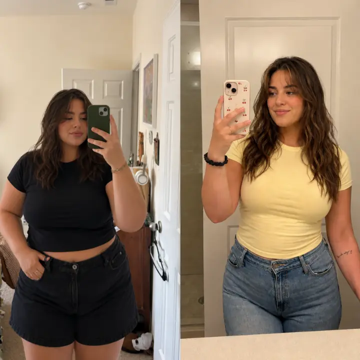 Everglow Miami patient before and after