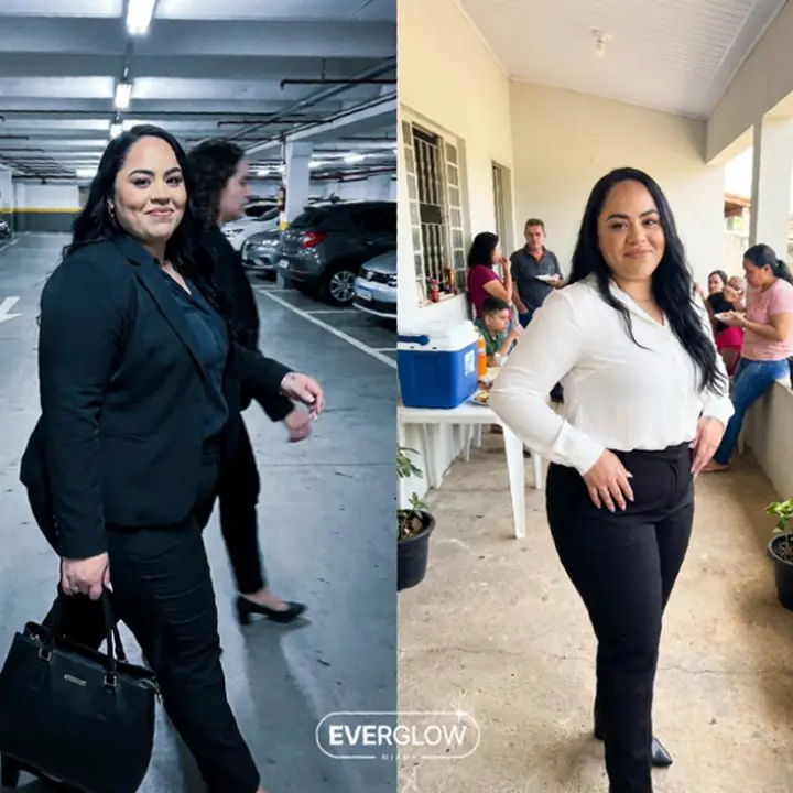 Everglow Miami patient before and after