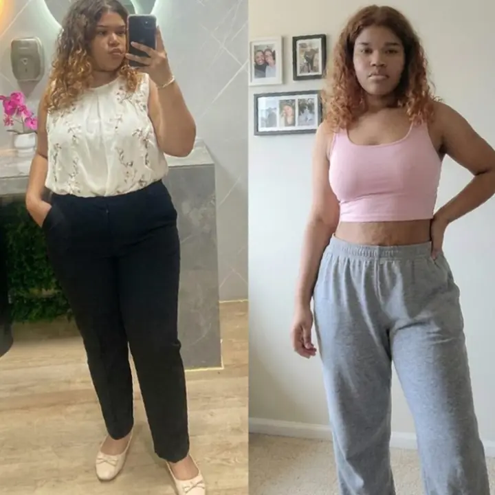 Everglow Miami patient before and after