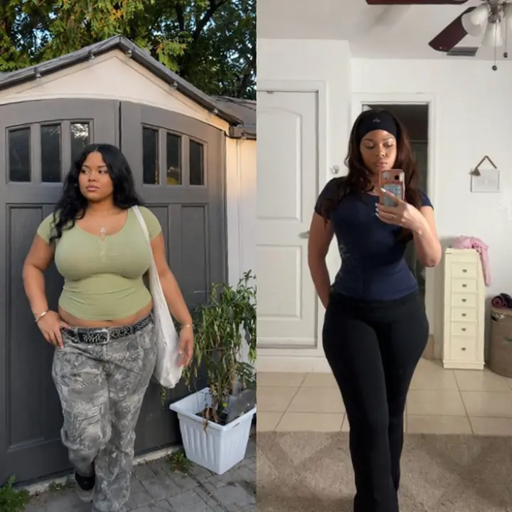 Everglow Miami patient before and after